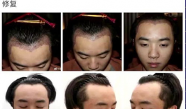 吃瓜爆料整容是真的吗,整容真相大揭秘